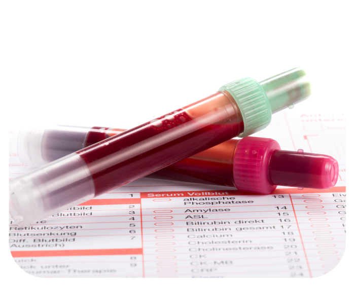 Zwei transparente Röhrchen mit roter Flüssigkeit.