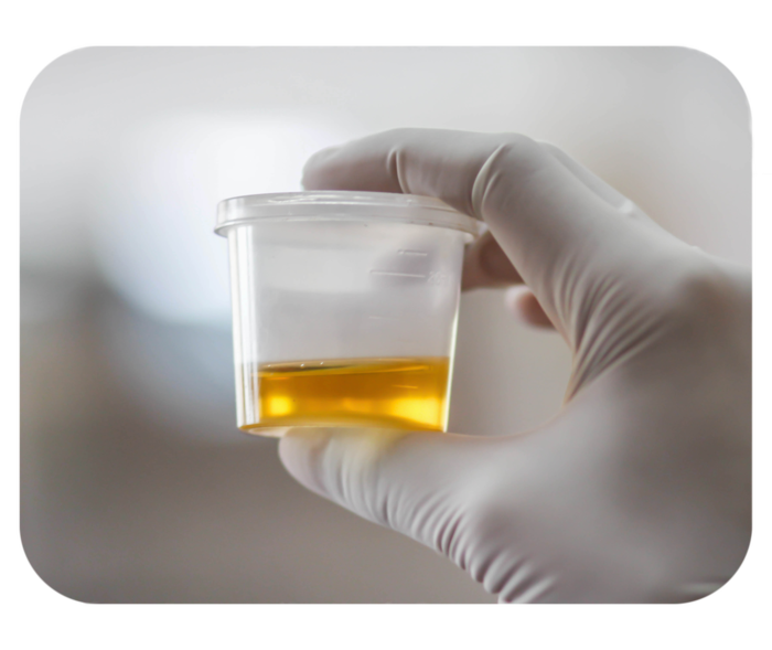 Hand in weißem Einweghandschuh hält einen transparenten Becher mit gelblicher Flüssigkeit.