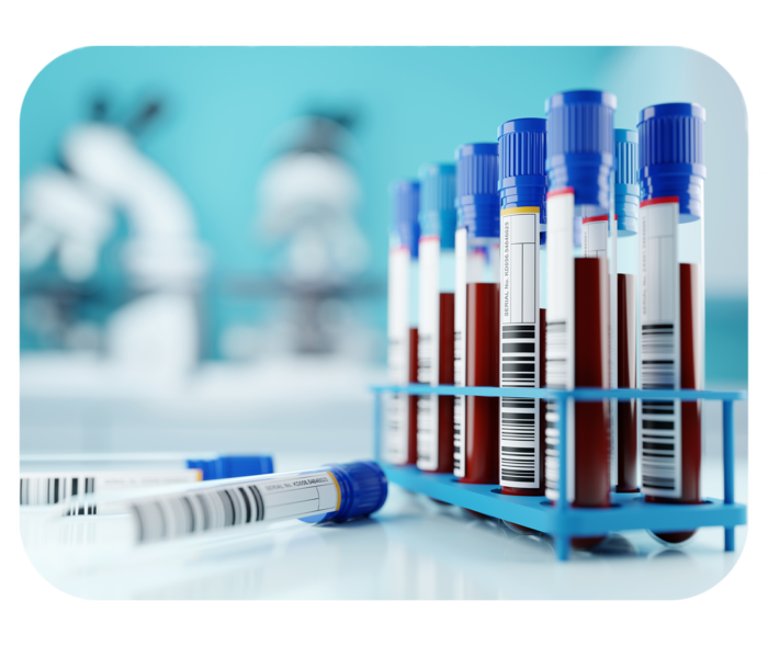 Mehrere Probenröhrchen mit roter Flüssigkeit in einem Ständer. Im Hintergrund zwei Mikroskope. 