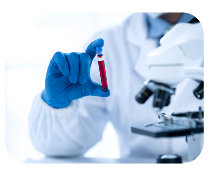 Eine behandschuhte Hand hält ein Blutröhrchen, im Vordergrund steht ein Mikroskop.