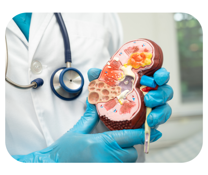 Oberkörper einer Person mit Stethoskop, die ein Modell einer Niere in der Hand hält.