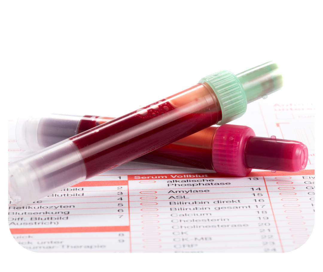 Zwei transparente Röhrchen mit roter Flüssigkeit.