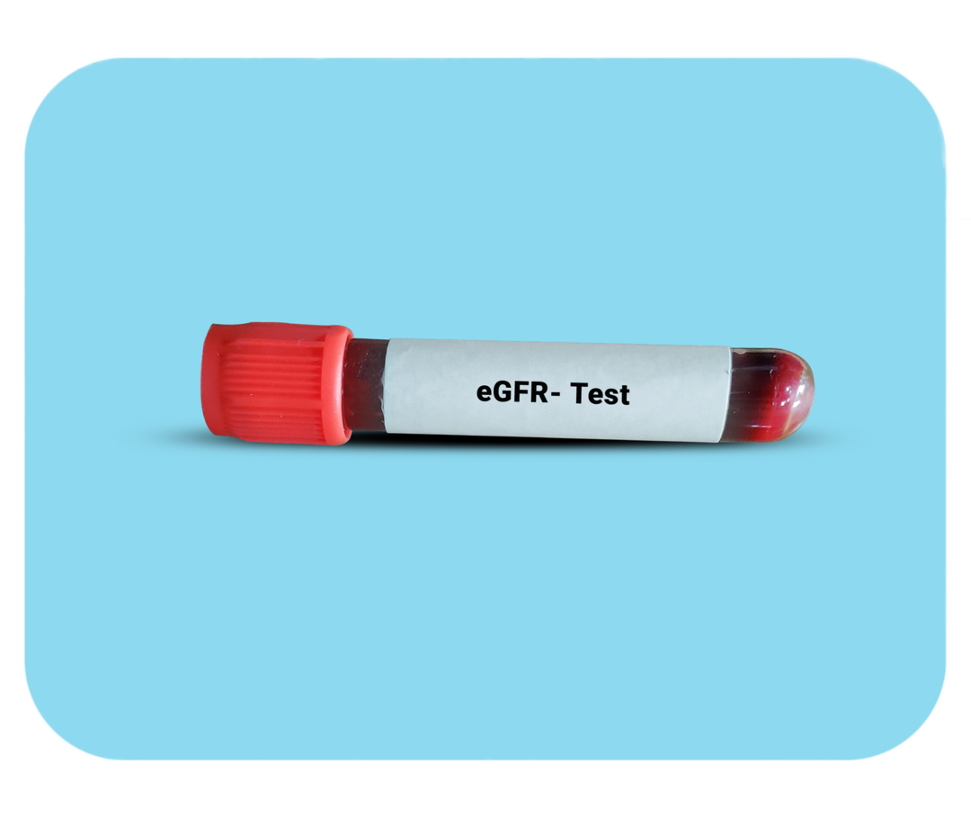 Röhrchen mit roter Flüssigkeit. Darauf steht: eGFR-Test.