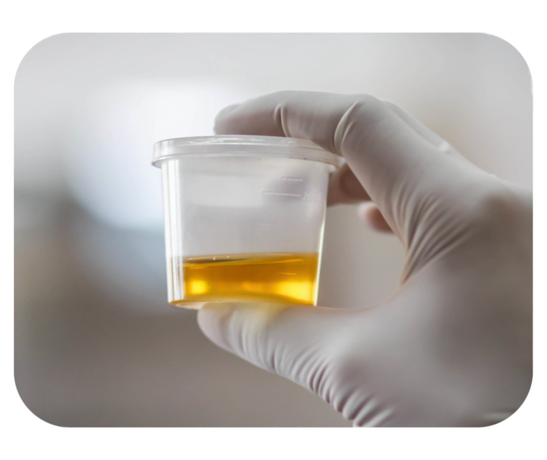 Hand in weißem Einweghandschuh hält einen transparenten Becher mit gelblicher Flüssigkeit.