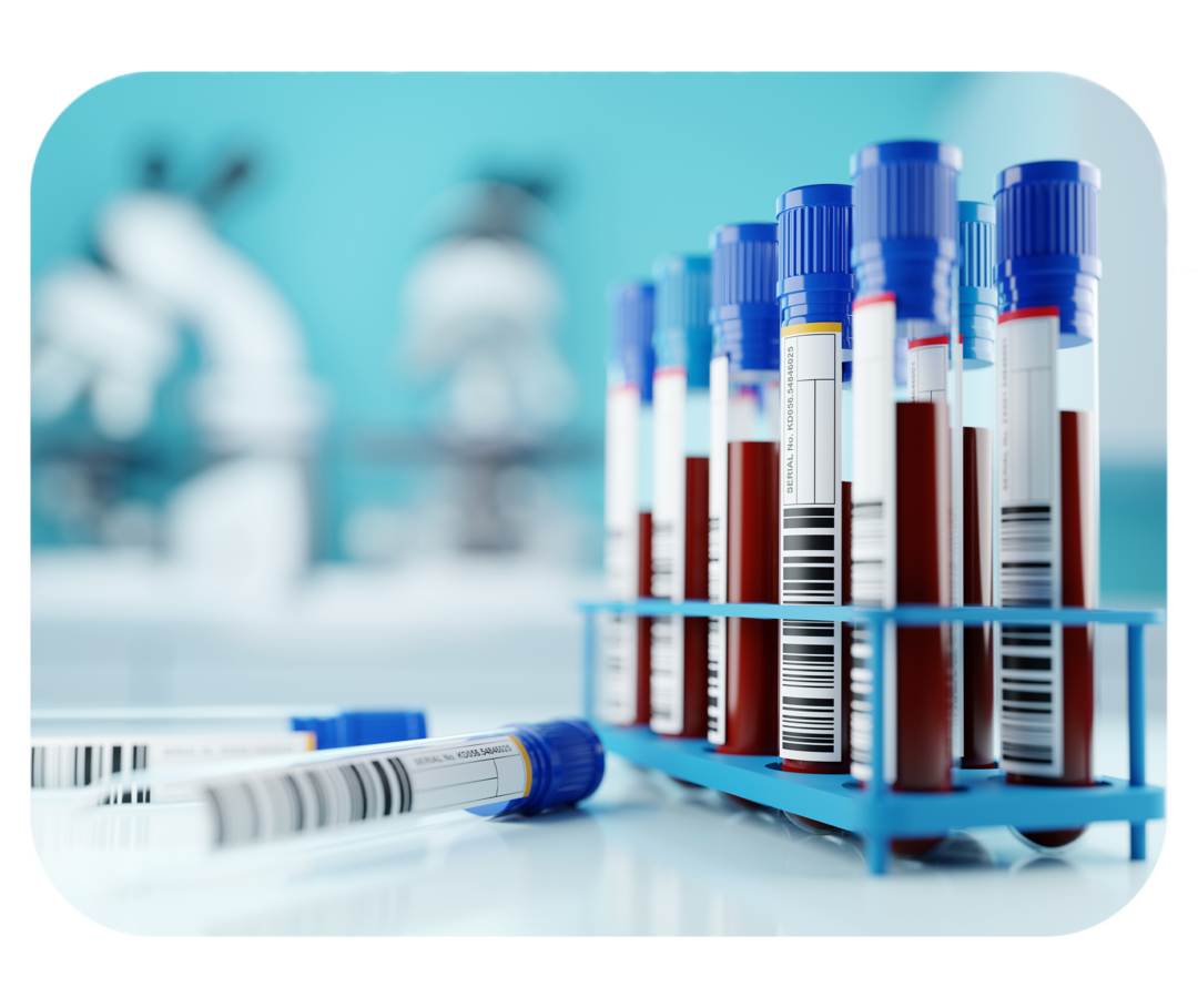 Mehrere Probenröhrchen mit roter Flüssigkeit in einem Ständer. Im Hintergrund zwei Mikroskope. 