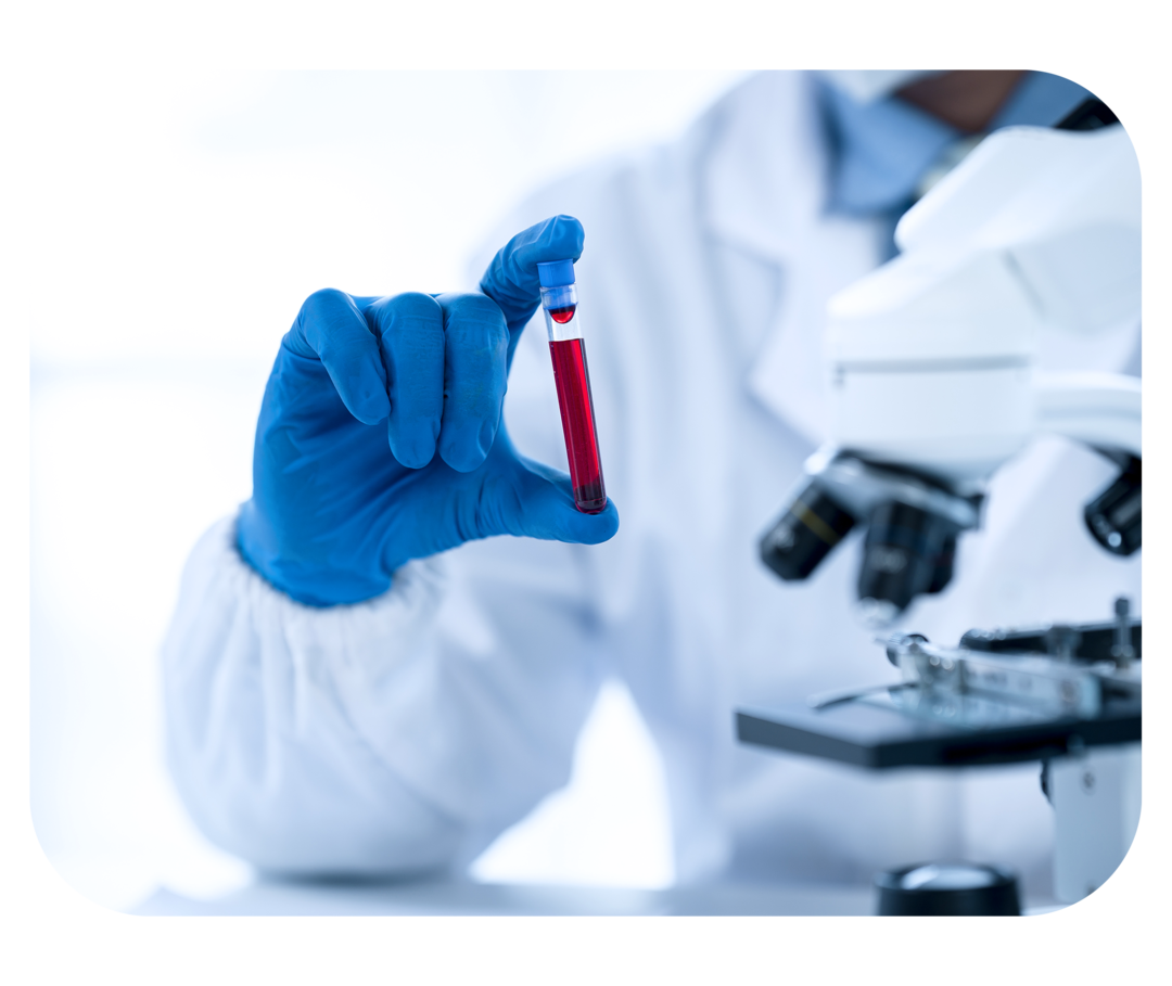 Eine behandschuhte Hand hält ein Blutröhrchen, im Vordergrund steht ein Mikroskop.