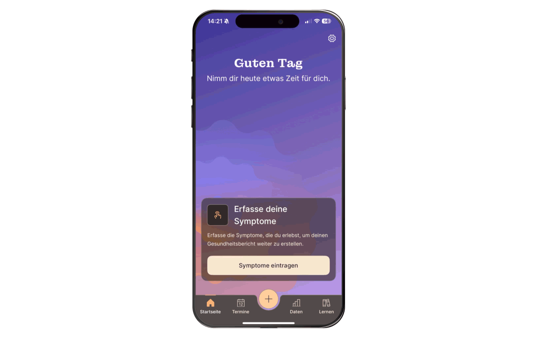 Animation, die die Erinnerungsfunktion zeigt